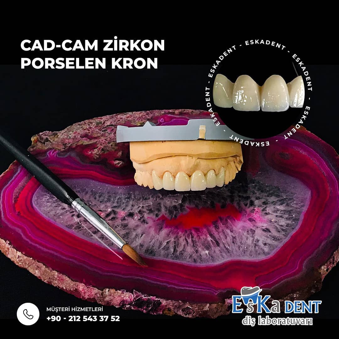 Cad Cam Zirkon Porselen Kuron